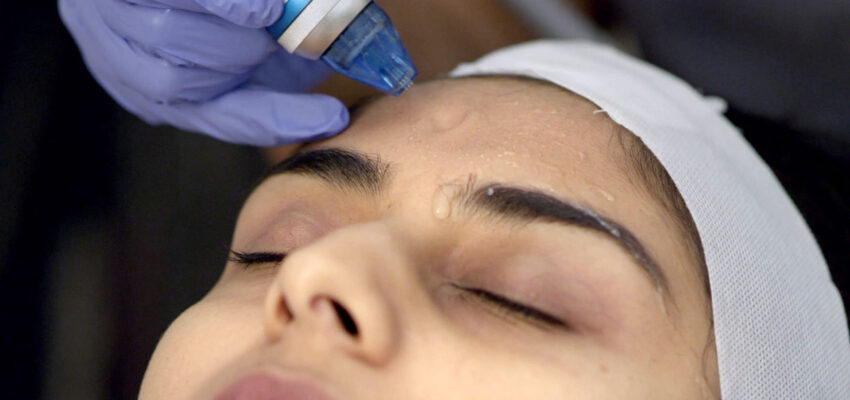 Microdermabrasion-Treatment-1