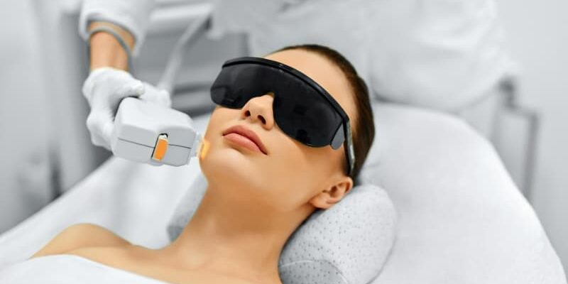 ipl-laser